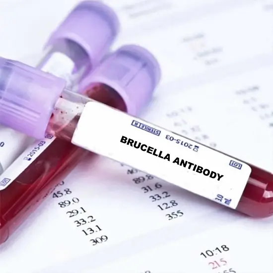 Brucella Antibody, IgG Test